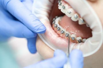 orthodontics